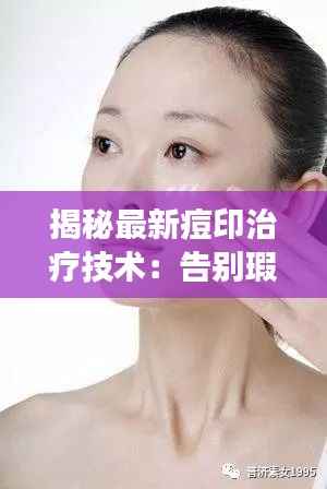 揭秘最新痘印治疗技术：告别瑕疵，重拾无瑕肌肤