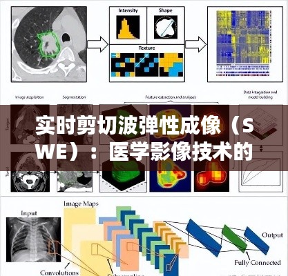 实时剪切波弹性成像（SWE）：医学影像技术的革新之路