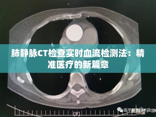 肺静脉CT检查实时血流检测法：精准医疗的新篇章