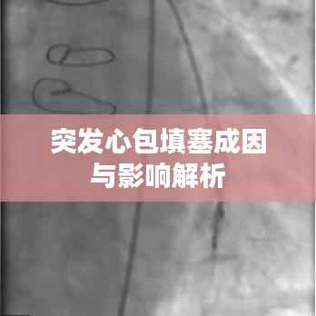 突发心包填塞成因与影响解析
