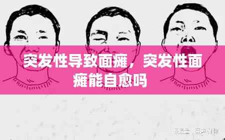 突发性导致面瘫，突发性面瘫能自愈吗 