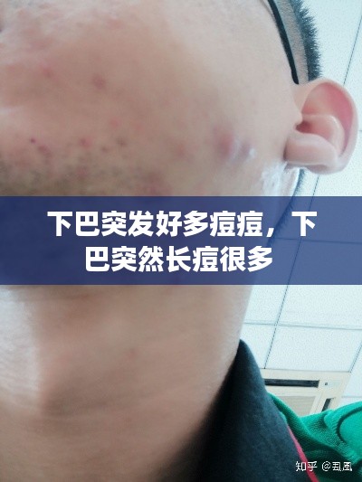 张弓拔弩 第5页