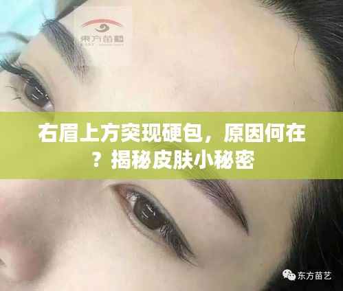 右眉上方突现硬包，原因何在？揭秘皮肤小秘密