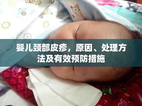 婴儿颈部皮疹，原因、处理方法及有效预防措施
