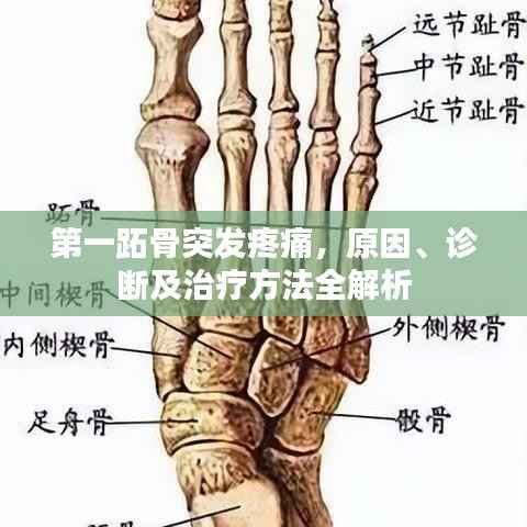 第一跖骨突发疼痛，原因、诊断及治疗方法全解析