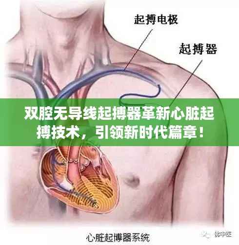 双腔无导线起搏器革新心脏起搏技术，引领新时代篇章！